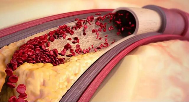 免疫系统 断食3天能重启人体免疫系统吗？美国研究发布结论，越早知道越好