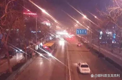 汤圆|近视手术“个性化”还原卓越视觉！