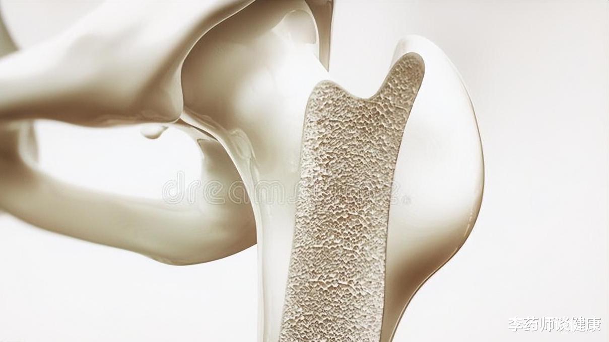 骨折|老年人摔一跤就骨折?不想骨头变脆,生活中避开这6件事