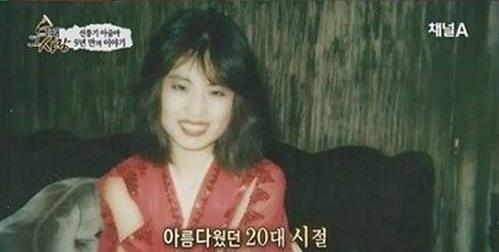 王一博|女星韩慧景:为了更漂亮,给脸注射食用油,把脸整成“猪头”