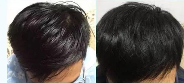 刘海 建议女生：头发软塌出油快，出门前加上这一步，能让头发干爽蓬松