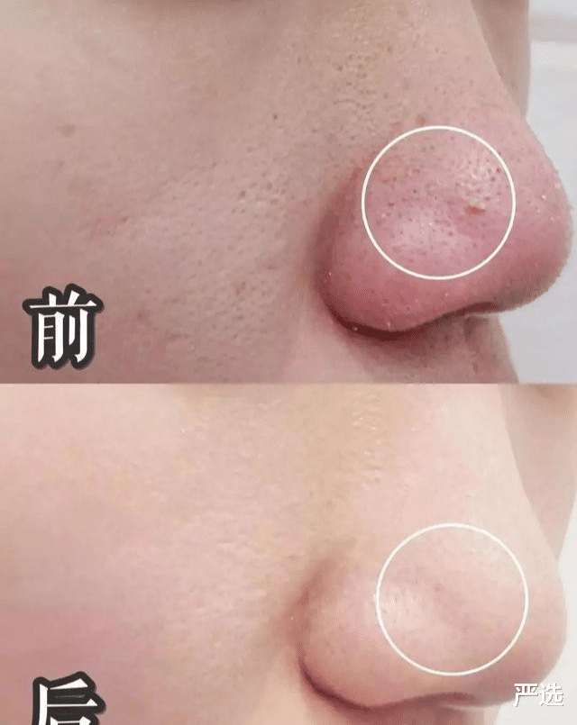 洗面奶 “洗面奶”查出致癌物！你的日用款上黑名单了吗？