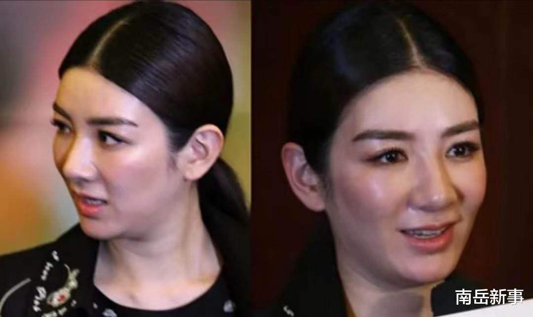 整容|整容、打针、过度减肥,9位浪姐为美太疯狂,面部僵硬认不出