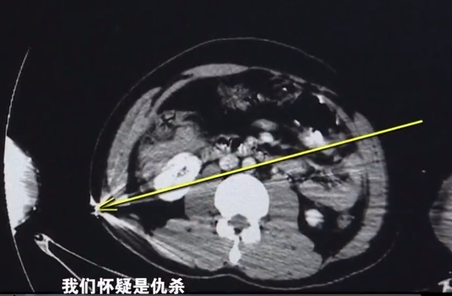 江苏男子深夜时突然中弹，嫌犯找人“顶包”自首