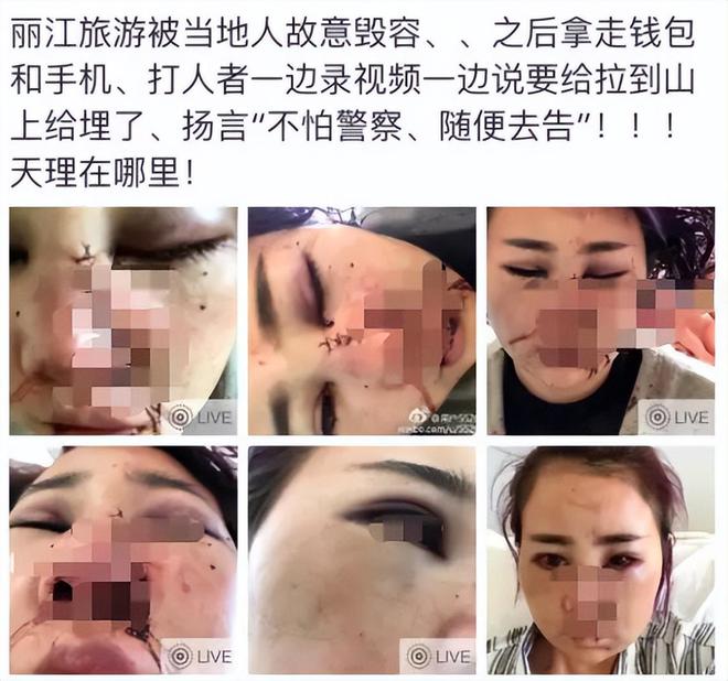 唐山被打女孩现状曝光,真相和我们想得不一样!