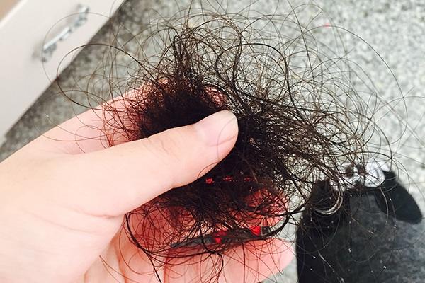 红斑狼疮|红斑狼疮早期，身体或会发出这些信号，这三类人群不要忽视