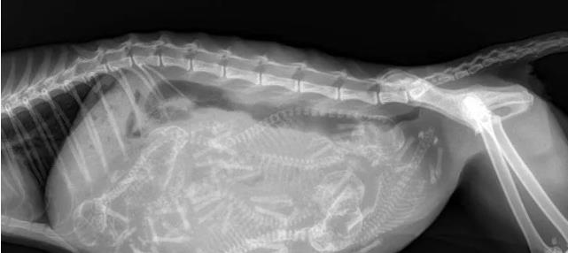 肺癌|盘点30张奇奇怪怪的X光片，看完整个人都不好了！