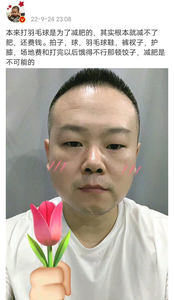 岳云鹏 岳云鹏晒减肥照片，抬头纹都出来了，网友：胖子不一定都是潜力股
