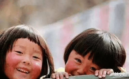 痘痘 春天,你脸红什么?