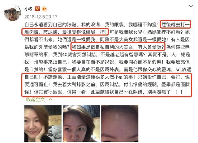 小S|孙艺珍40岁庆生照被嫌老，小s打抱不平怒发文，反问网友颜值几何