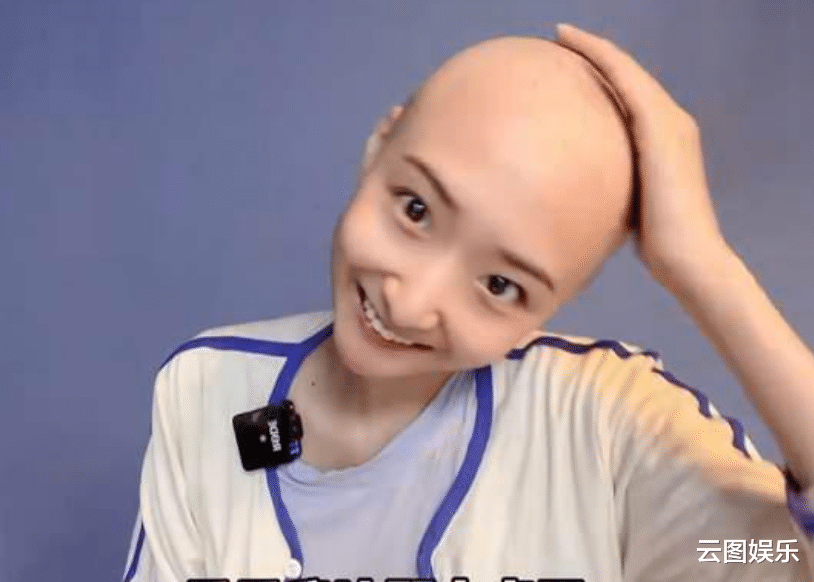 抗癌|28岁网红苏日曼癌症去世！8个月前确诊，化疗后狂掉光头身材消瘦