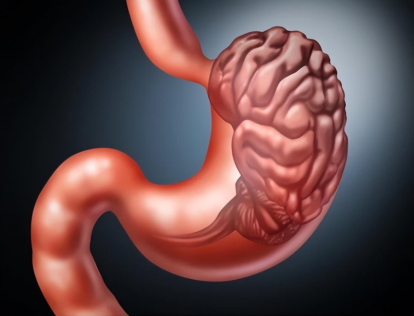 肠胃有“独立大脑”,70%防御细胞与其关联,这么多脑子不打架?