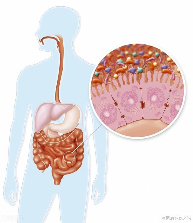新型冠状病毒肺炎|糖尿病人怎么防治新冠病毒感染?国际研究:肠道菌群很重要