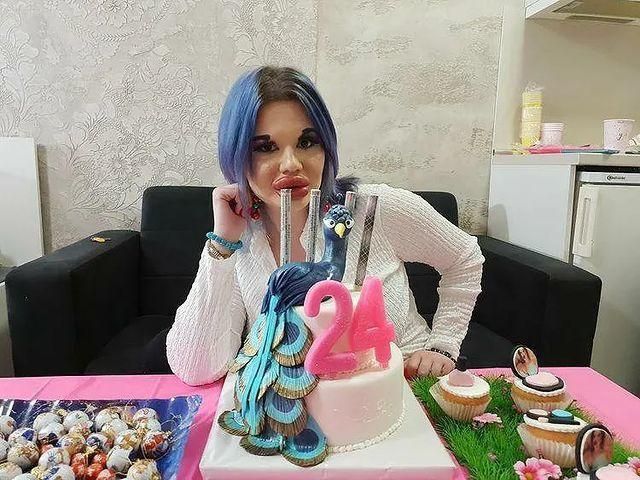 全世界嘴唇最厚的人 23岁女子4年血本30次丰唇 欧阳锋都自愧不如