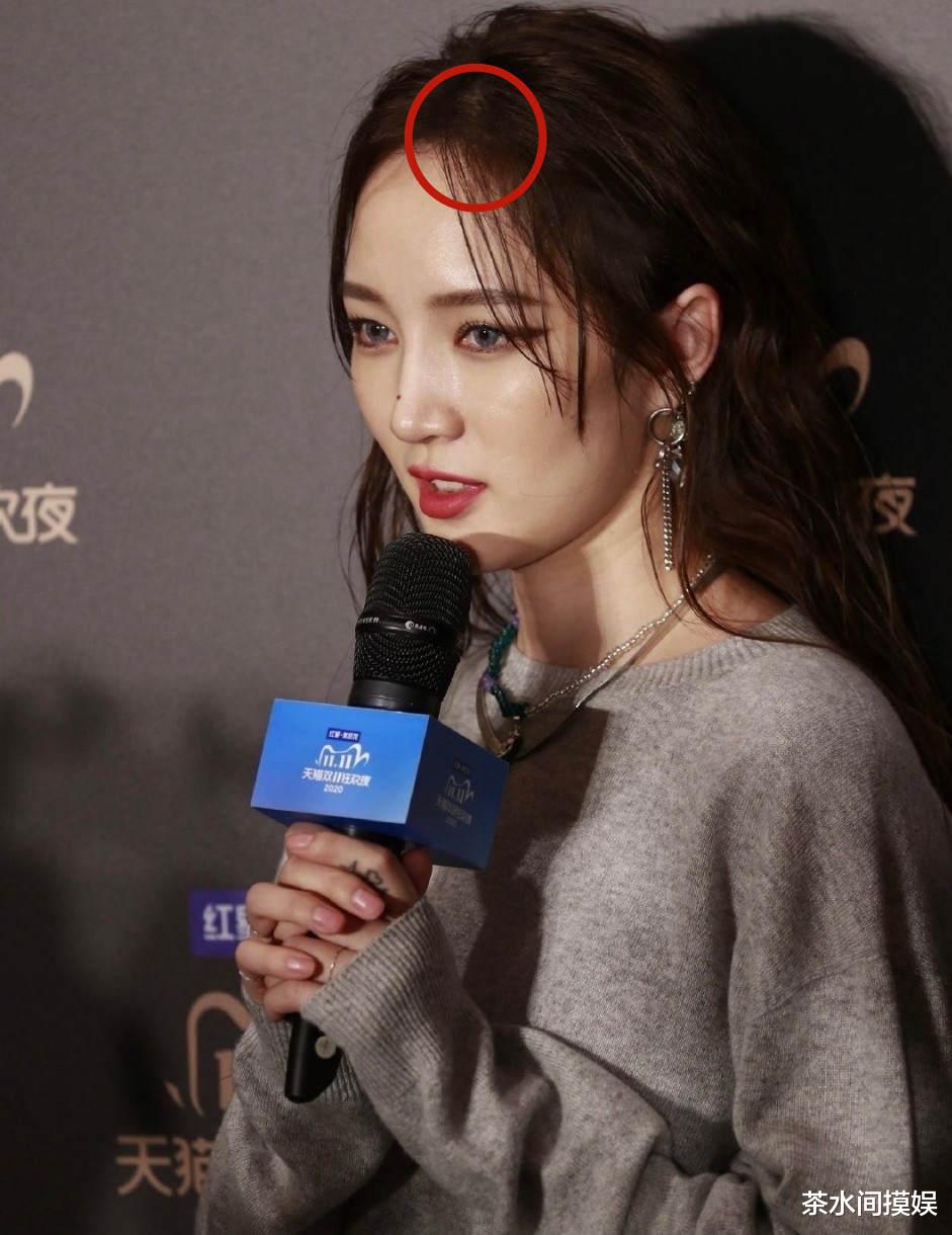 辣妹|女明星也有秃头危机？有人发际线堪比清朝阿哥，有人走路掉假发片