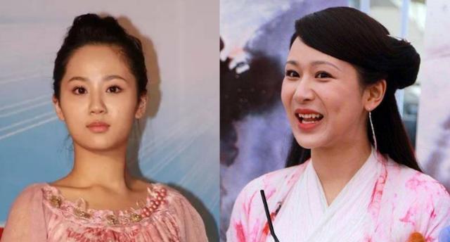 杨幂|从“大饼脸变成小V脸”的9位明星，杨幂说整了牙，金晨死鸭子嘴硬