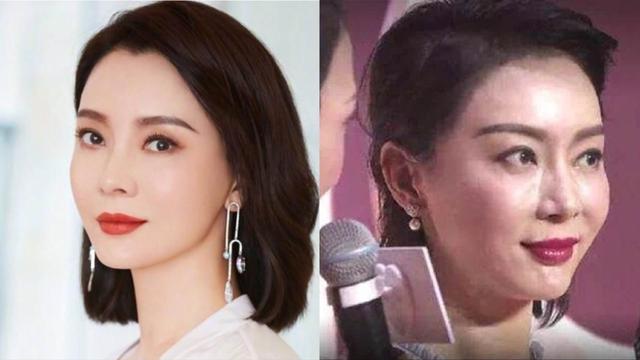 整容 明星整容后遗症:“一刀削”脸僵挂不住肉,演戏五官乱飞,没眼看