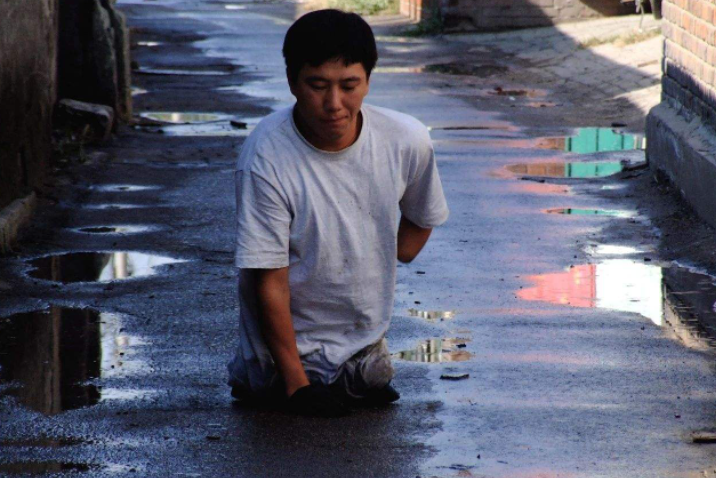 1996年,他只因捡条“钥匙链”揣兜10小时,成我国首例核辐射案受害者
