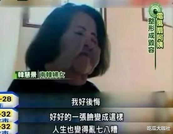 整容|10位整容毁掉的女星：有人自己注射食用油，有人上瘾，有人丢了命