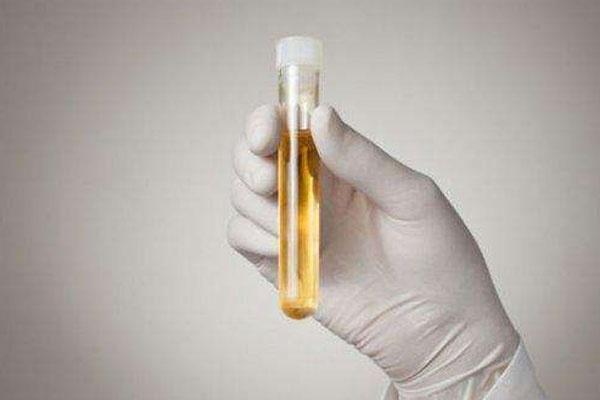 |早起第一泡尿,出现这3个现象,可能是肾脏给你敲的“警钟”