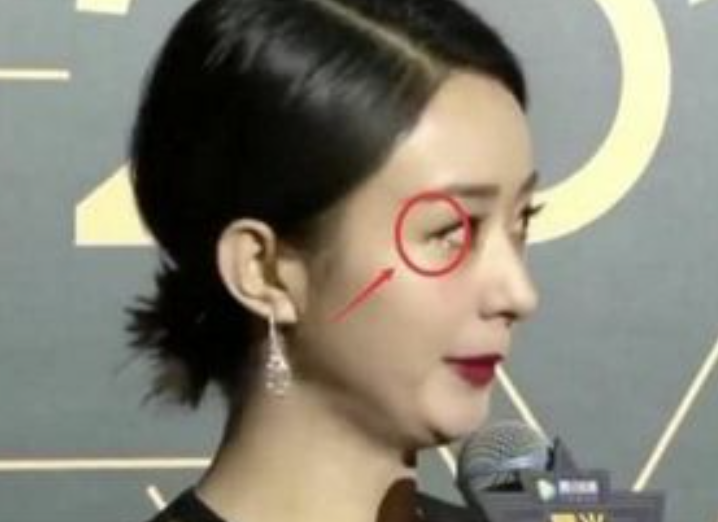 杨幂|零下8度女星红毯：杨幂手冻黑靠哈气取暖拒受访，赵丽颖被冻出泪