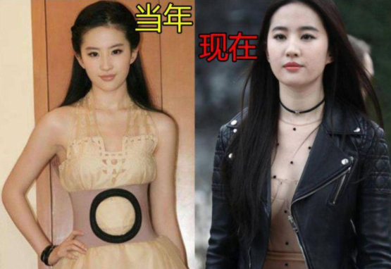 郑秀文|瘦到病态、动脸成瘾、强行装嫩，内娱的“畸形审美”真是刷新三观