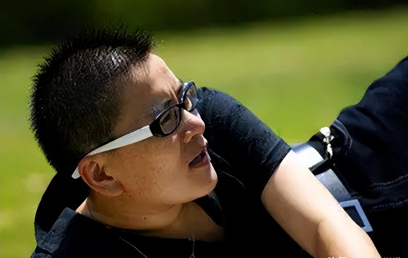 医生|2005年，中国首位“女变男”易性人，不听劝阻，如今现状如何？