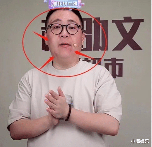 郝劭文|郝劭文满脸抓痕疑遭家暴，妻子二婚带7岁女儿，郝劭文晒幸福回应