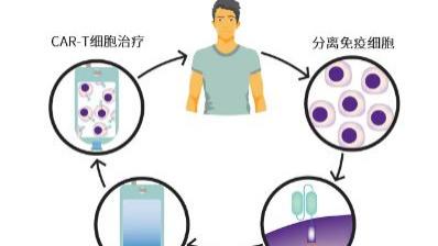 脐带血CAR-NK细胞疗法或成肿瘤免疫治疗新利器