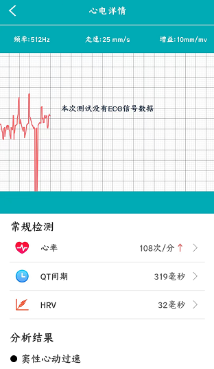 dido|dido G28S心电血压智能手表：90后必备的一款健康智能手环
