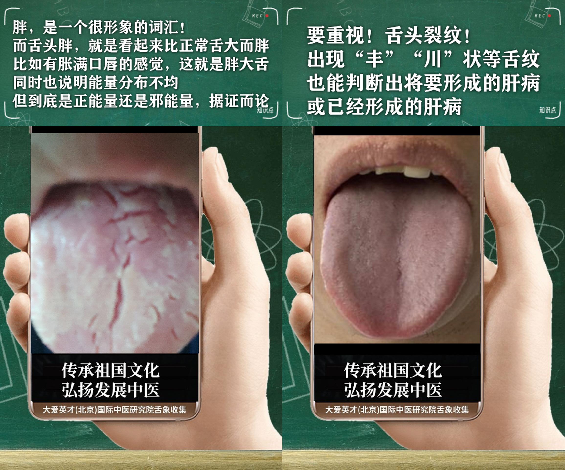 安神|中医病症：懦弱、手足心热、痰多色白、一直未愈很难受