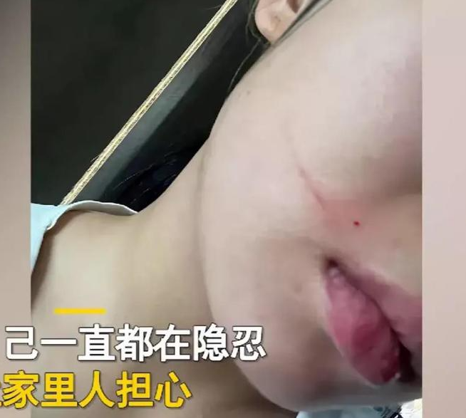 安徽一女子新婚怀孕后近7个月被丈夫施暴,且两人还未领证。
