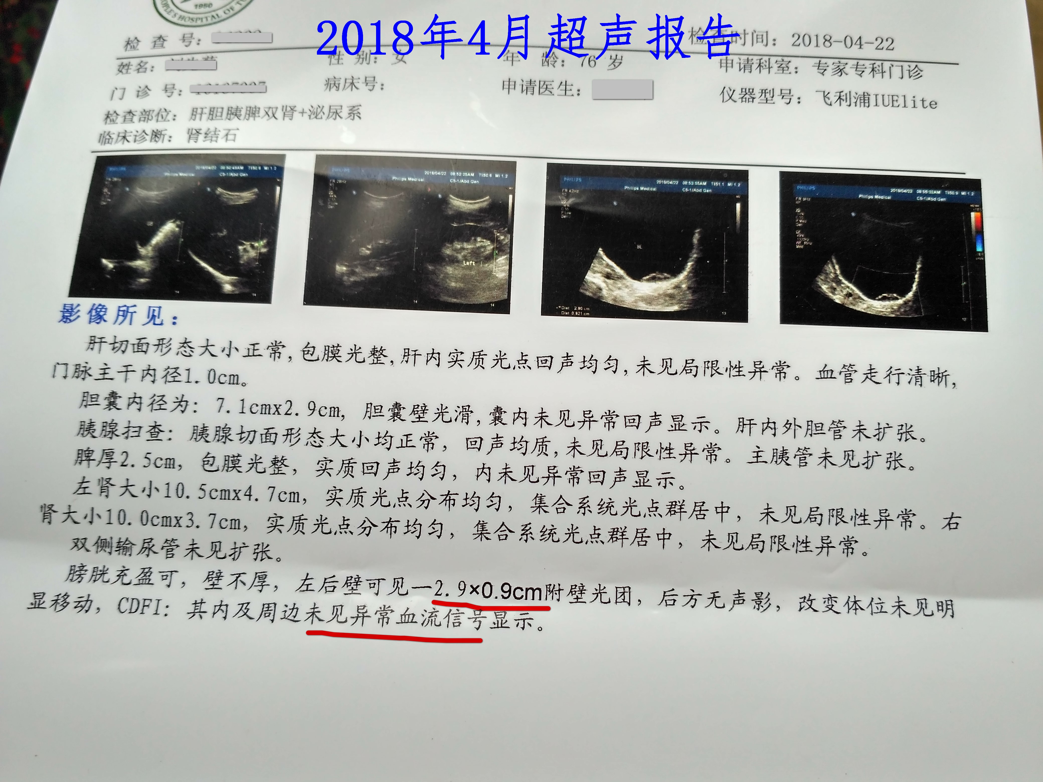 猪肉|膀胱肿瘤不手术,只吃中药行不行?