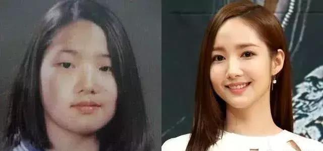 整形|10位大方承认整形的韩国明星，这种自爆真的需要勇气！