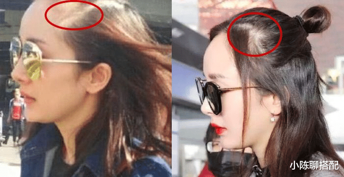 发际线 发量是如何影响颜值的?