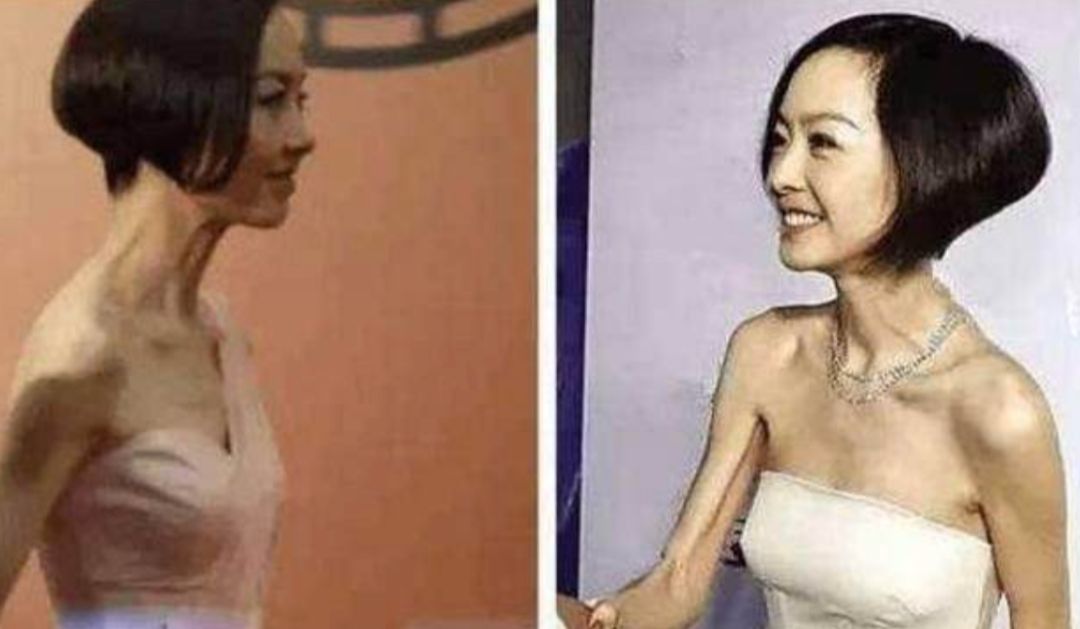 明星 动脸成瘾、强行扮嫩、为减肥切胃洗肠，女星的畸形审美好可怕