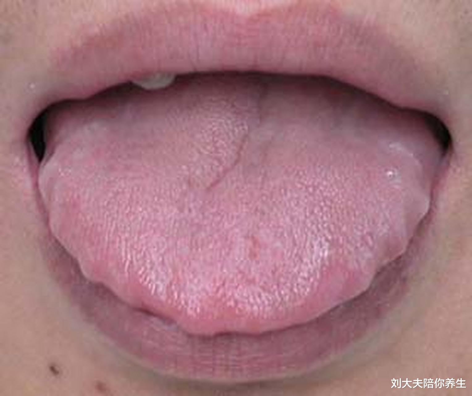 脾胃|内伤脾胃,百病丛生!十人有九脾虚,无外乎3大因素,不可忽视