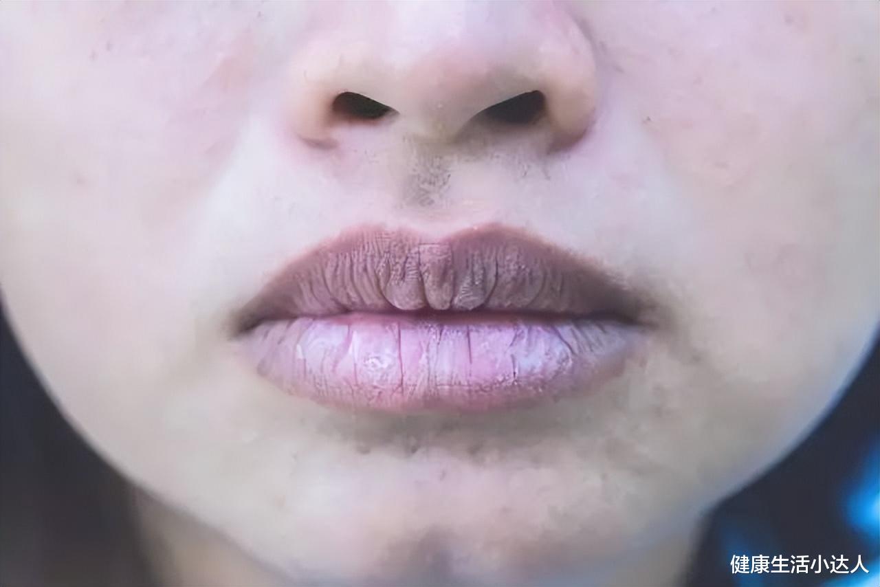 中药|常吸烟的人,5个地方发黑,十有八九是肺受损了,及时查CT