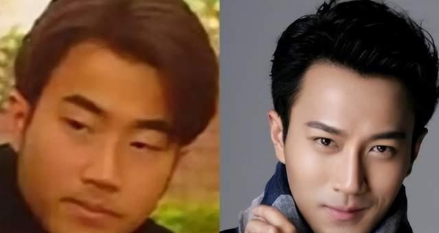 整容|如今的高颜值男星，有人曾经方脸塌鼻梁，有人原生脸像整容脸
