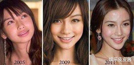 整容|“微整”成功的6位女明星：杨某身价倍增，谢某事业爱情双丰收！