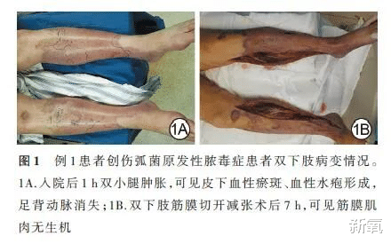 具惠善|继曲线女明星和爱新觉罗汪扯头花后，安宰贤和具惠善也舞起来了？