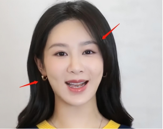 杨紫|杨紫近照再惹争议！面部僵硬似整容，苹果肌浮肿被吐槽像发面馒头