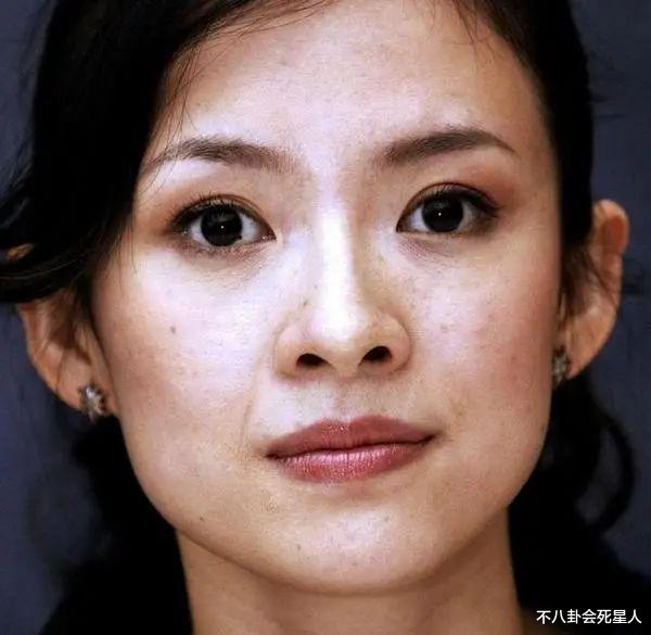 生图|精修是神颜,生图满脸痘,痘坑、黑眼圈、长斑,明星没那么美