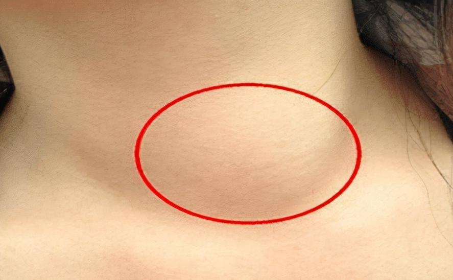 干眼症|多家医院联合呼吁:芹菜和2物同食,堪称“散结王”,敞开吃,结节或消失无踪