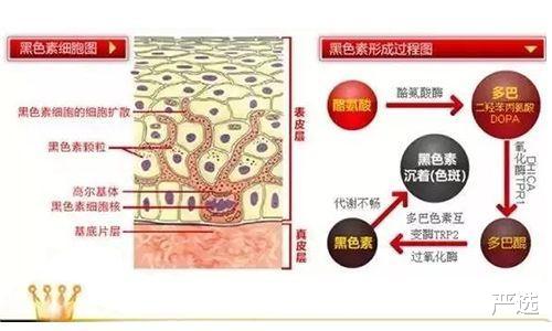 高跟鞋 6年前打美白针成“白灯泡”的女人，现在啥样，网友：还好没跟风