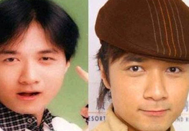 成龙|割完单眼皮就好事不断的6位港星,成龙脱胎换骨,甄子丹迅速起飞