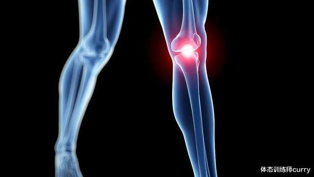 失眠|腿不直，小腿还粗？你可能存在这种体态，这6个动作要经常练！