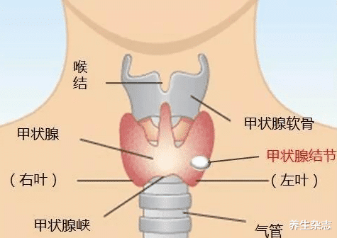 甲状腺|数名院士呼吁：停止食用厨房1调料，它正在“掏空”你的甲状腺