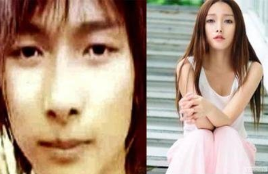 金星|因童年家庭不幸走上“隆胸”之路，他们后悔了吗