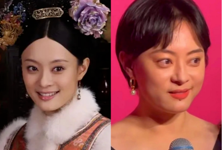 孙俪|邓超近照暴瘦，五官大变样，孙俪也眼凸脖子鼓，这对夫妇是咋了？